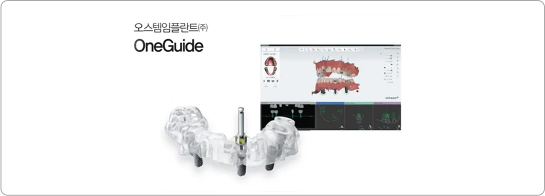 오스템임플란트