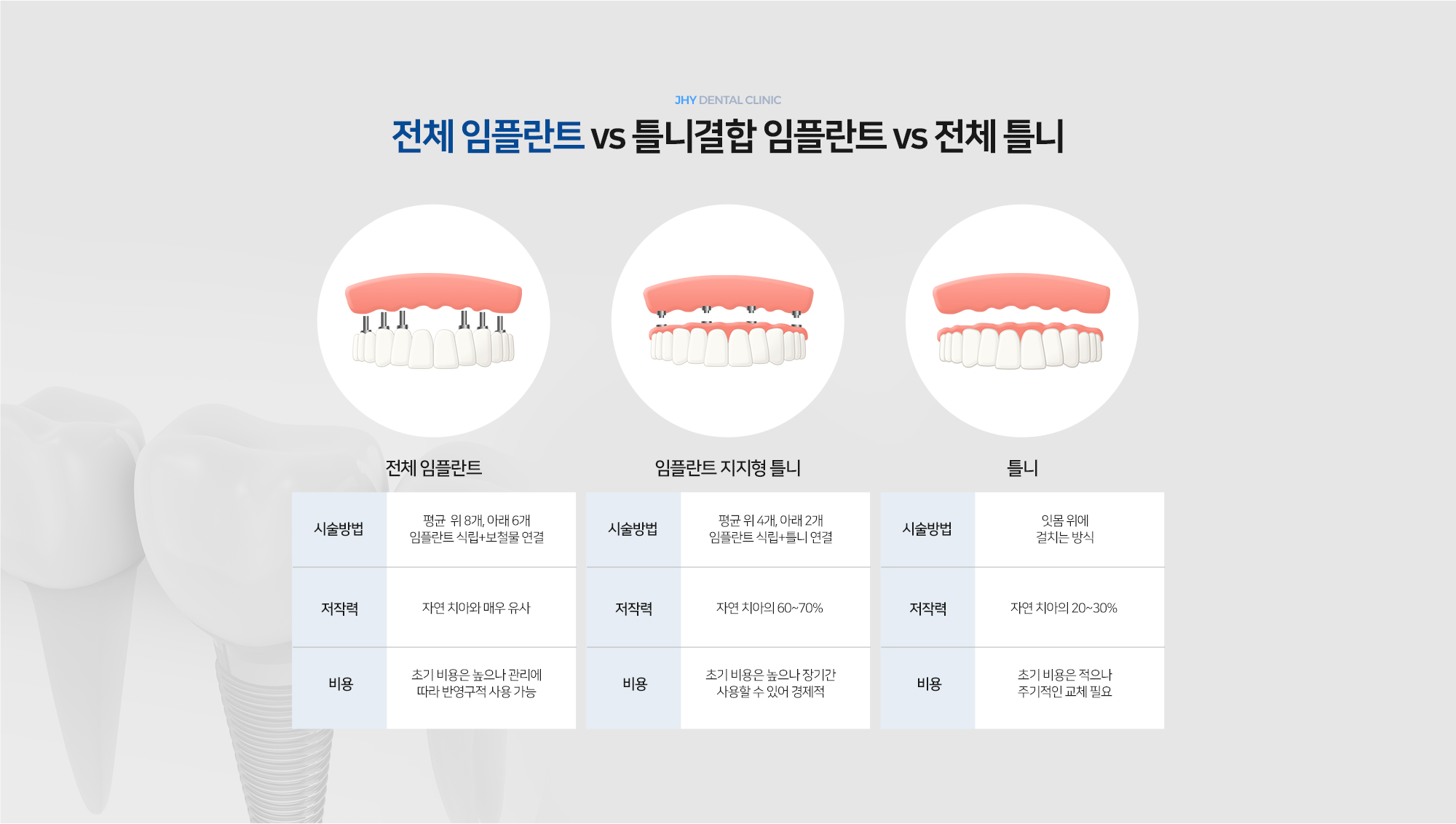 전체 임플란트 vs 틀니결합 임플란트 vs 전체 틀니