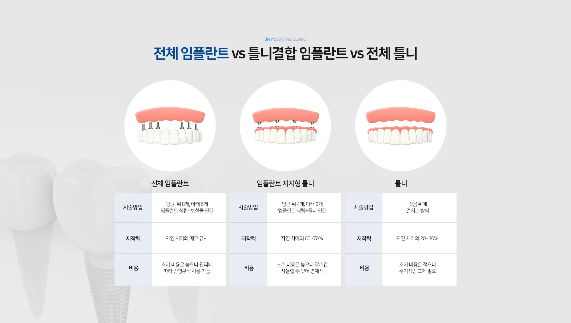 전체 임플란트 vs 틀니결합 임플란트 vs 전체 틀니