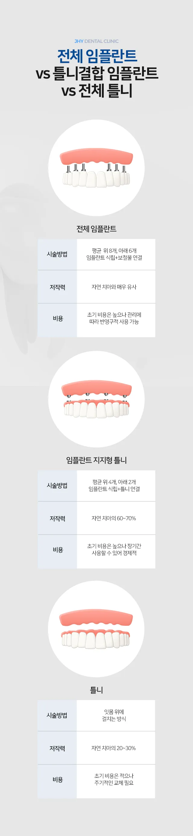 전체 임플란트 vs 틀니결합 임플란트 vs 전체 틀니