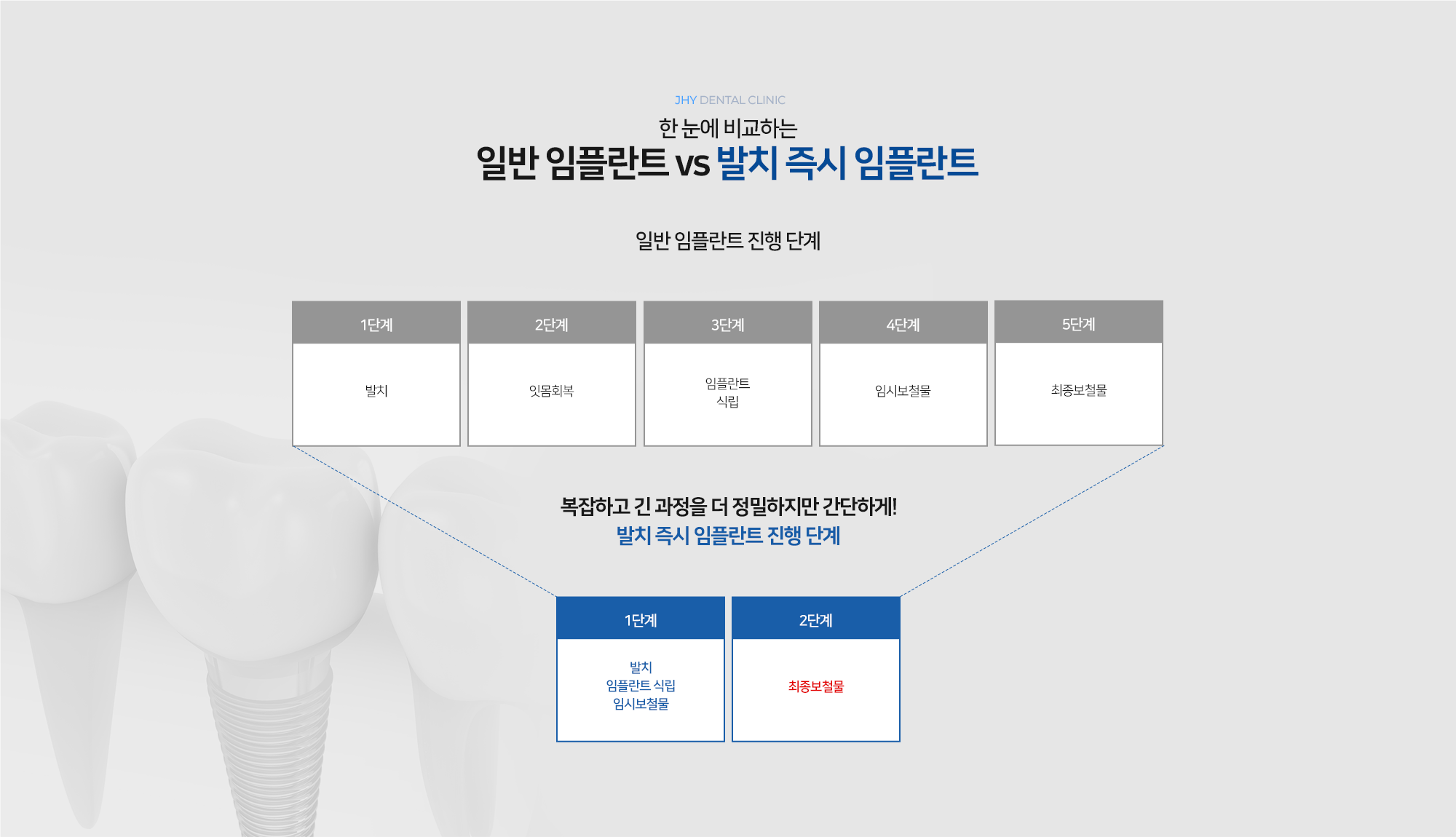 일반임플란트 vs 발치즉시임플란트