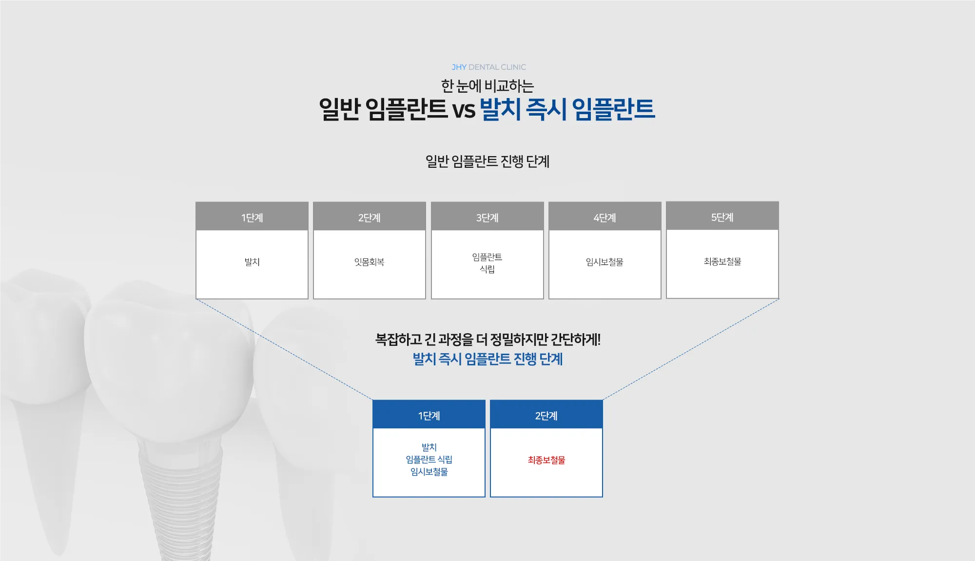 일반임플란트 vs 발치즉시임플란트