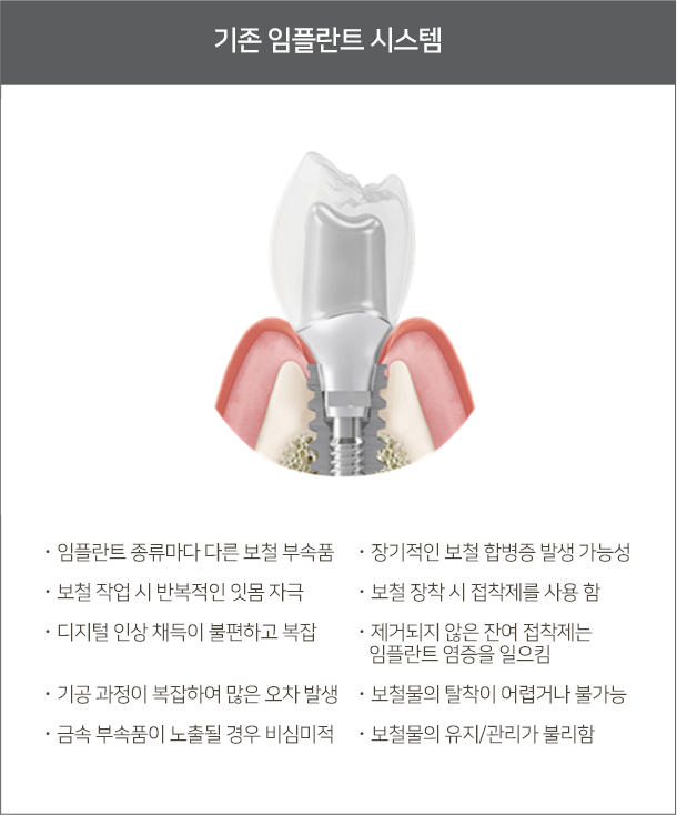 기존 임플란트 시스템