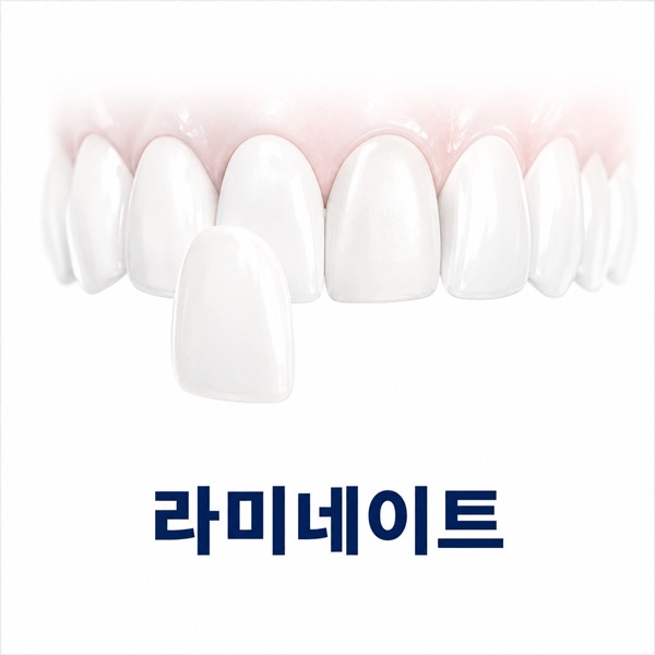 라미네이트