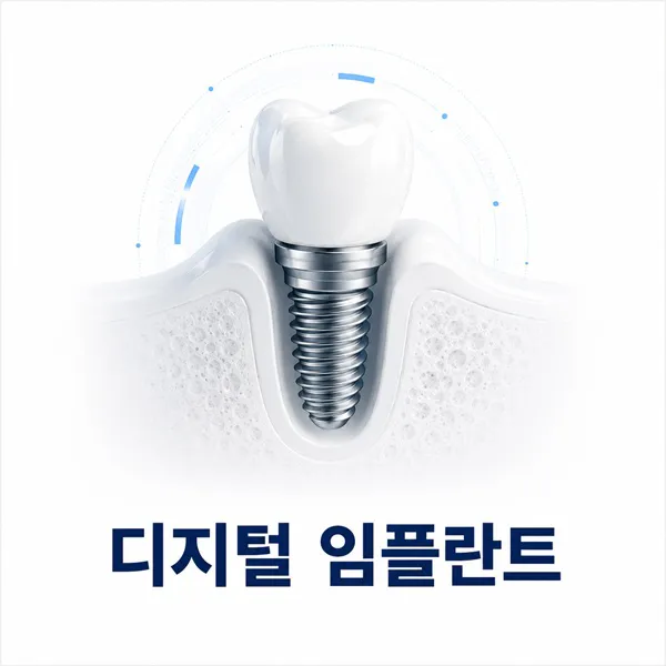 디지털 임플란트