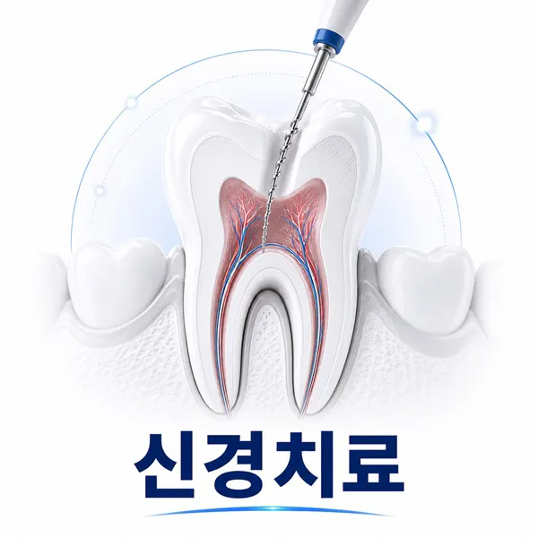신경치료